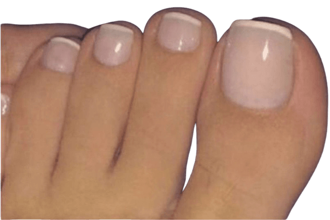 french tip toes
