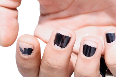 chipped black nail polish - Google Search