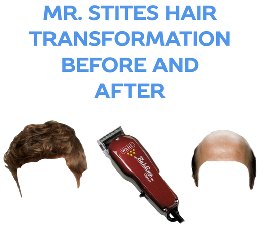 Mr Stites bald spot