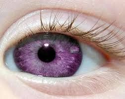 unique beautiful heterochromia eyes - Google Search