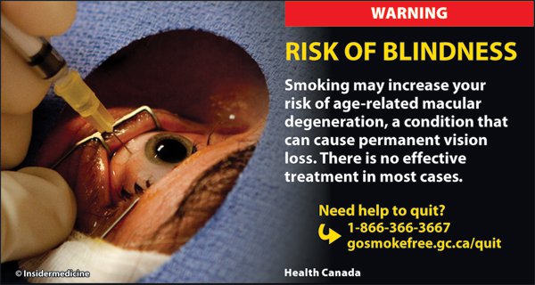 Canada 2012 Health Effects eye - vision loss, gross - cigars eng.jpg (600×320)