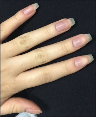 clean nails