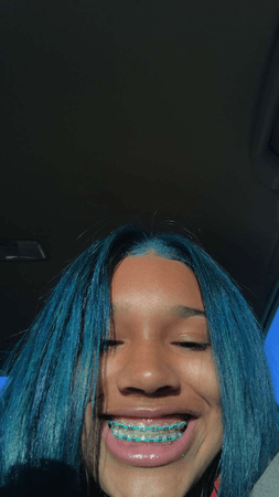 black girl braces at DuckDuckGo