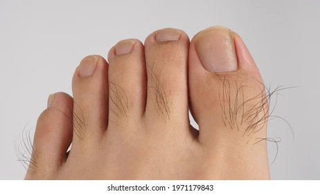 Hairy Toe
