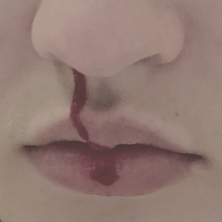 nose bleed asthetic - Google Search