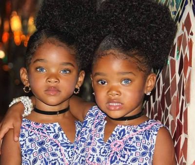 EverydayKoala The Trueblue Twins: Instagram Sensations with Gorgeous Eyes