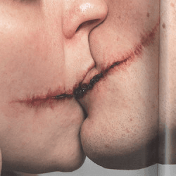 kissing scars