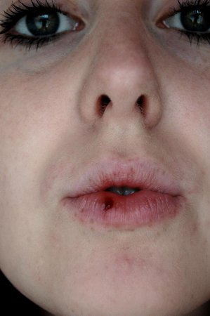 Split lip. by LadyBird-18208 on DeviantArt