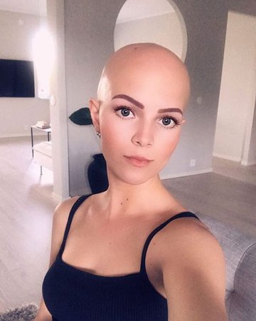 bald pretty hair girl - Google Search