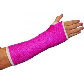 Pink arm cast