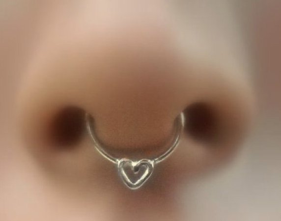 heart septum ring