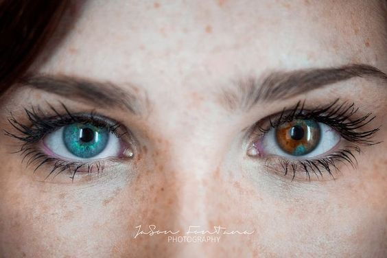 Heterochromia eyes brown blue