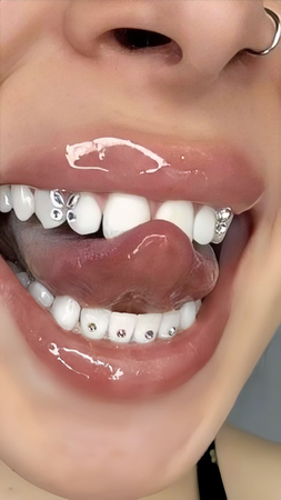 teeth gems