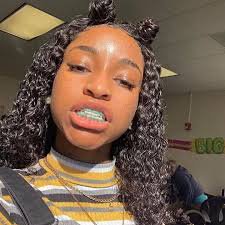 face cute girls with braces instagram - Google Search