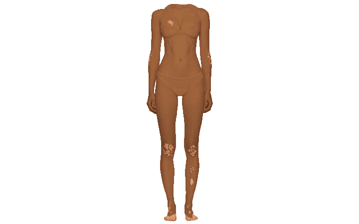 Vitiligo Body - Naira Triple Scoop (based on loginasalah on ig)