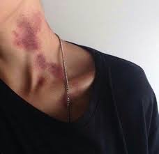 mood hickey goals - Google Search
