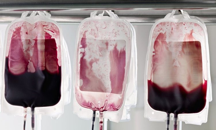 Blood grown from stem cells could transform transfusions | Innovation | Pinterest | Blood, Blood donation and Vampire diaries