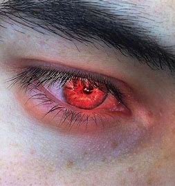 red eyes -