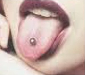 Tongue_Piercing_Image_Internet
