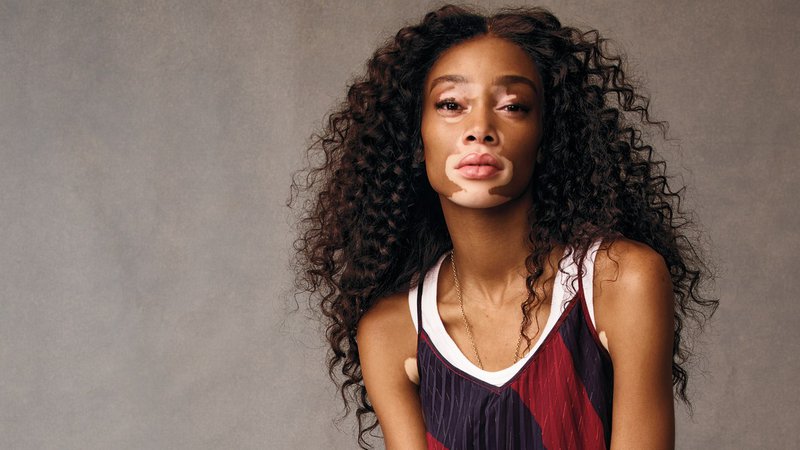 Winnie Harlow: 'It’s Beautiful That the Age of Cookie-Cutter Models Is Ending' - Glamour