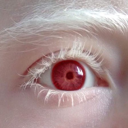 Albino Eye