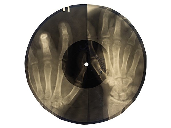 Inside the Covert World of Bootleg X-Ray Records