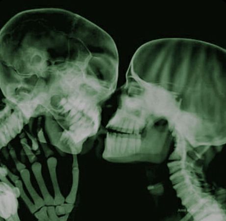 skull kiss