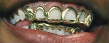 gold grill