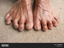dirty toes - Google Search
