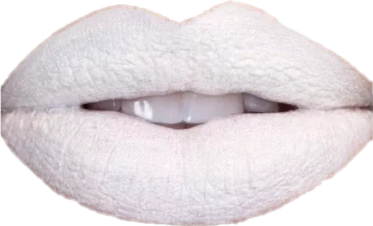 White Lip 1