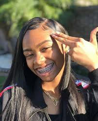 mouth with braces black girl - Google Search