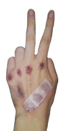 bruised peace png