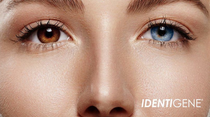 DNA and Heterochromia: Two Different-Colored Eyes! - HomeDNA Paternity