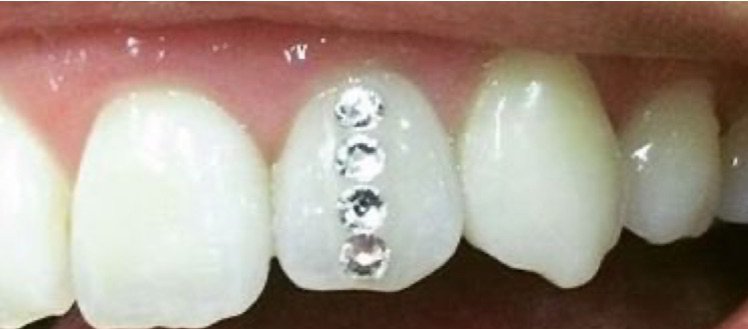 Teeth Jewels