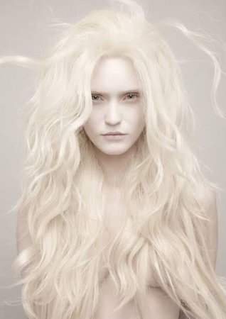 albino beauty