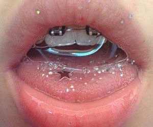 glitter lips with braces