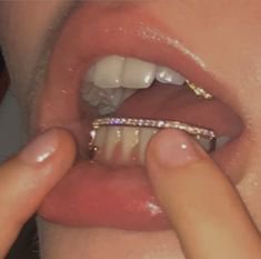 teeth diamonds
