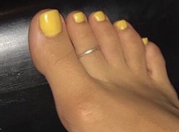 yellow toe nail