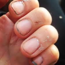 dirty nails - Google Search