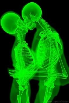 neon green X-ray