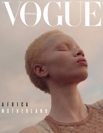 vogue-portugal-thando-hopa-primeira-modelo-capa-albinismo.jpg (997×1292)