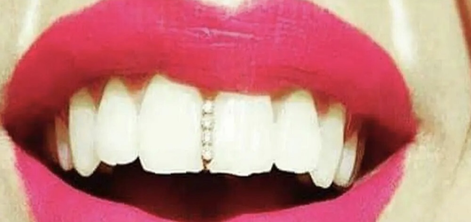 tooth sparkle