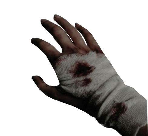 bandaged wounded hand