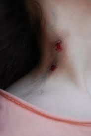 vampire bite marks on neck real - Google Search