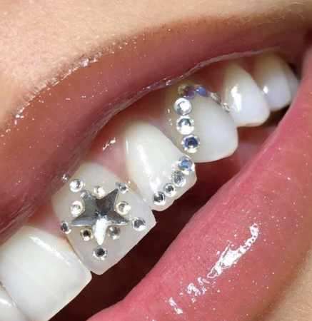 star tooth gems