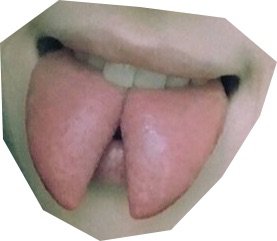 Split tongue