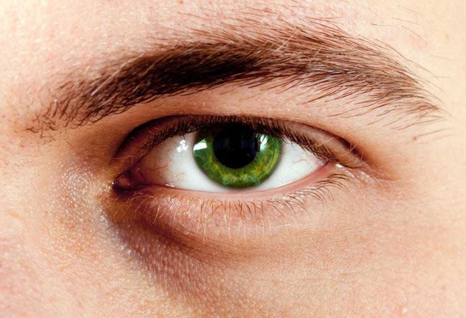 Green Eye (Male)