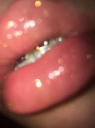 glossy lips with braces - Google Search