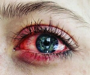 red eyes cry - Google Search