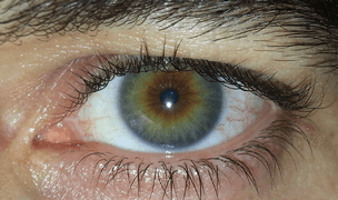 hazel eyes 3 colours - Google Search